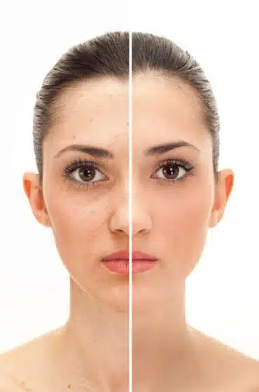 Before-and-after example of natural portrait retouching